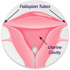 FemChec Step 2