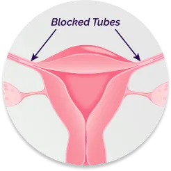 FemChec Step 5