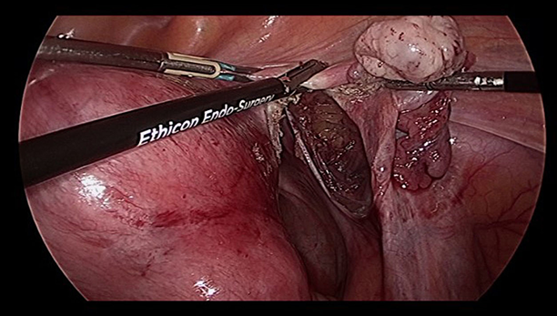 Surgery photo